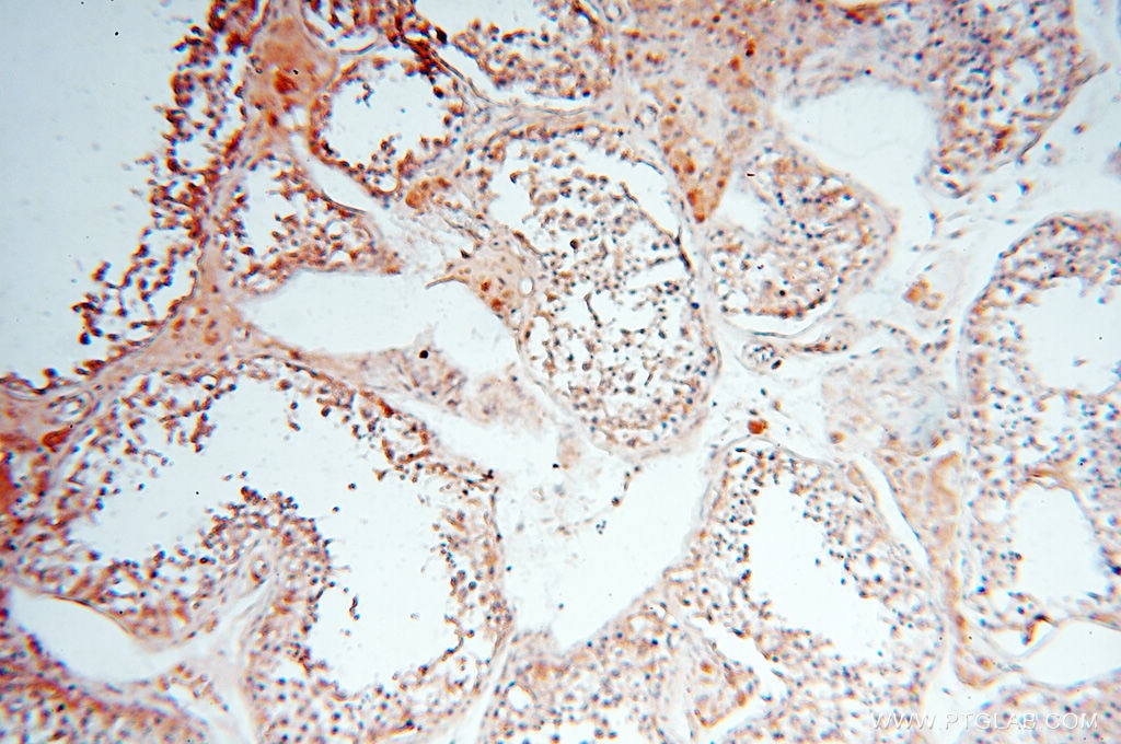 Immunohistochemistry (IHC) staining of human testis tissue using CA11 Polyclonal antibody (15435-1-AP)