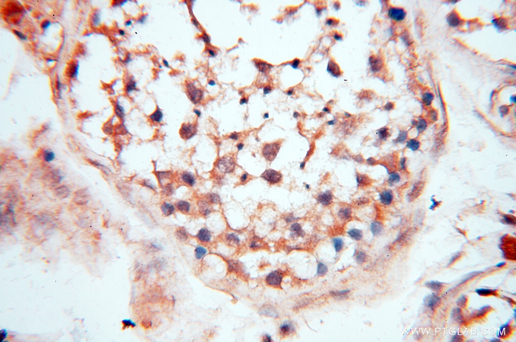 Immunohistochemistry (IHC) staining of human testis tissue using CA11 Polyclonal antibody (15435-1-AP)