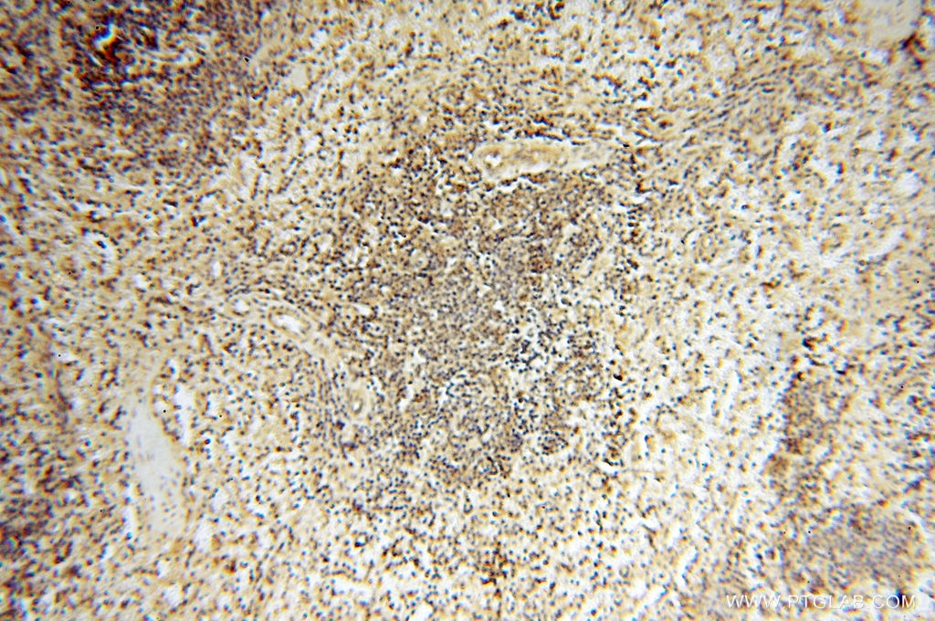 Immunohistochemistry (IHC) staining of human spleen tissue using CA11 Polyclonal antibody (15435-1-AP)