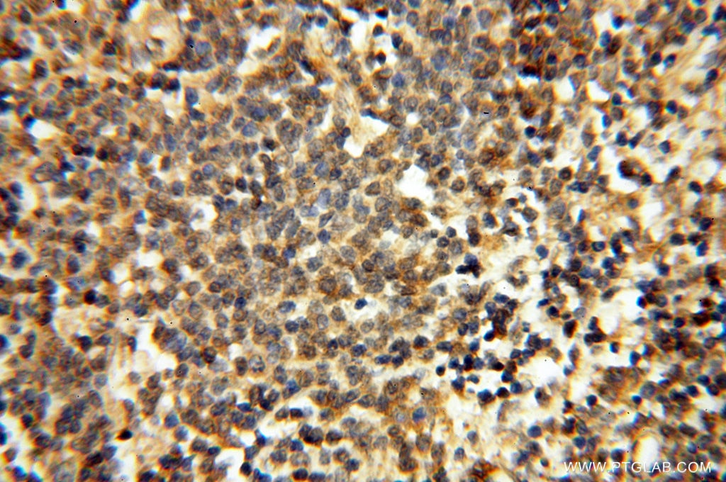 Immunohistochemistry (IHC) staining of human spleen tissue using CA11 Polyclonal antibody (15435-1-AP)