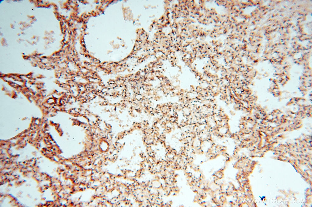 Immunohistochemistry (IHC) staining of human lung tissue using CA11 Polyclonal antibody (15435-1-AP)