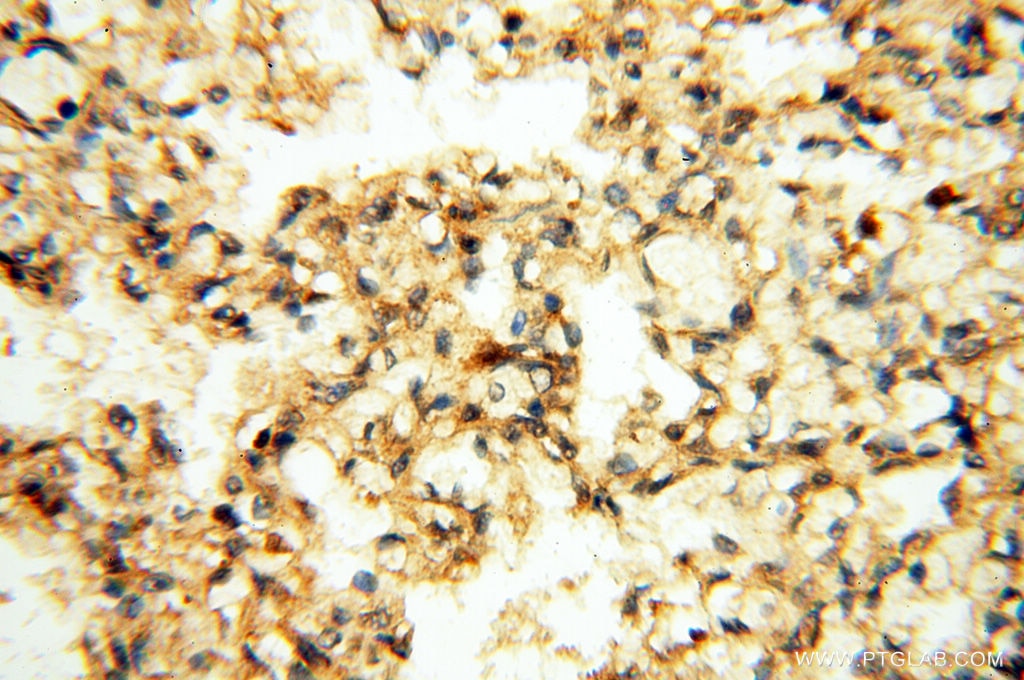 Immunohistochemistry (IHC) staining of human lung tissue using CA11 Polyclonal antibody (15435-1-AP)