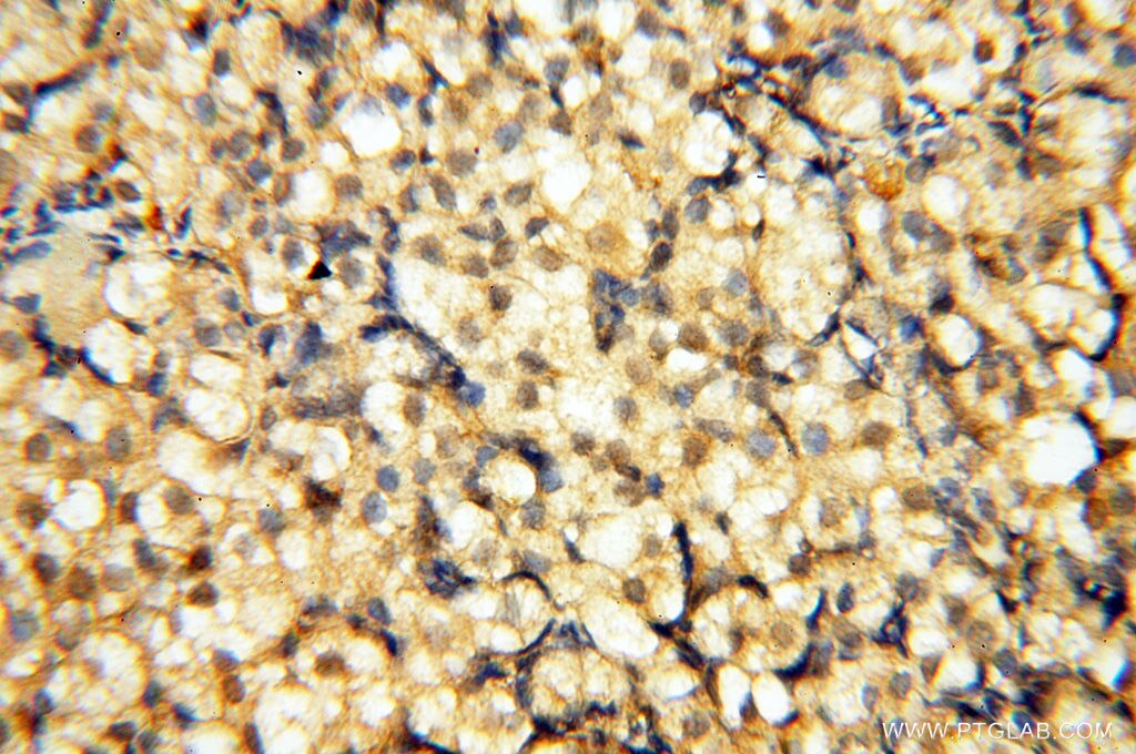 Immunohistochemistry (IHC) staining of human ovary tissue using CA11 Polyclonal antibody (15435-1-AP)