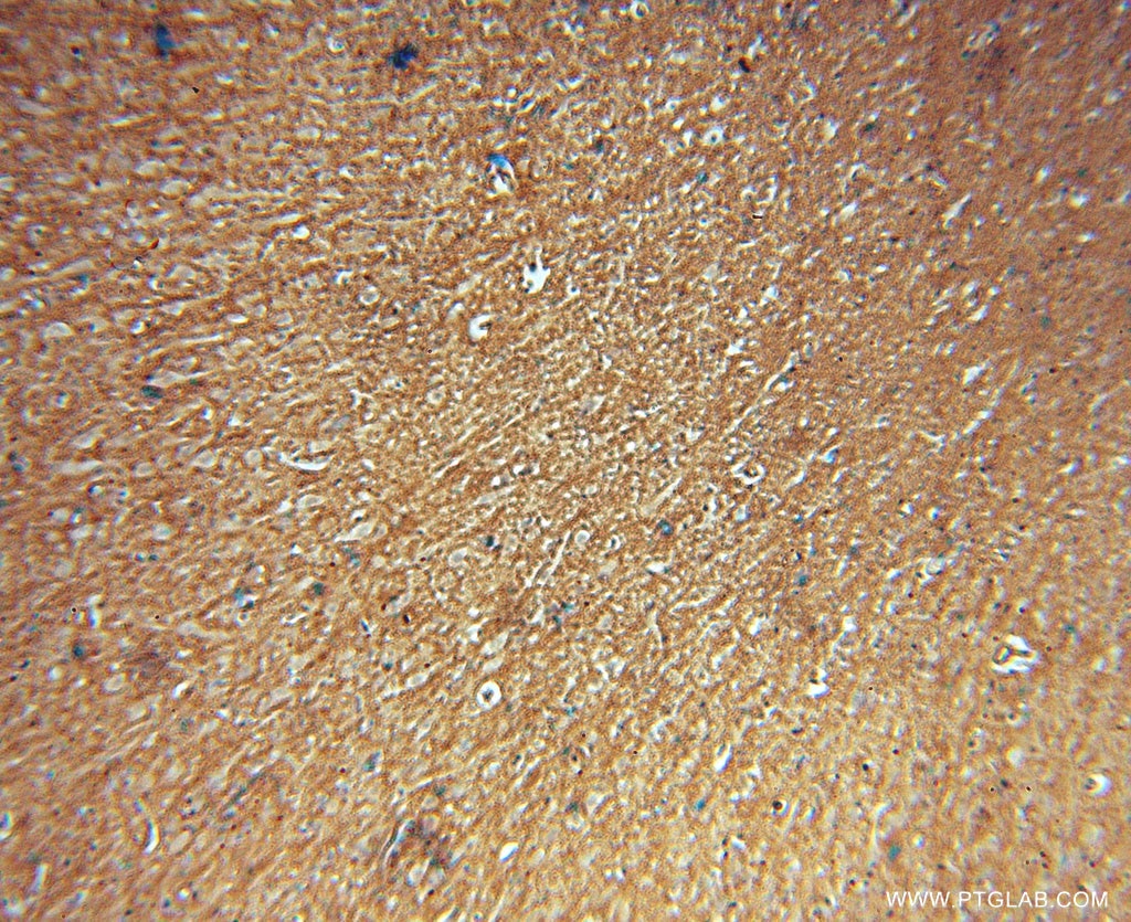 Immunohistochemistry (IHC) staining of human brain tissue using CA11 Polyclonal antibody (15435-1-AP)