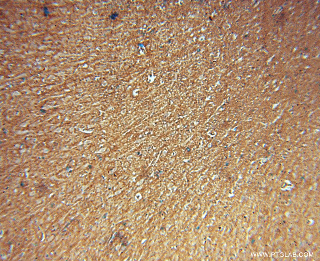 IHC staining of human brain using 15435-1-AP