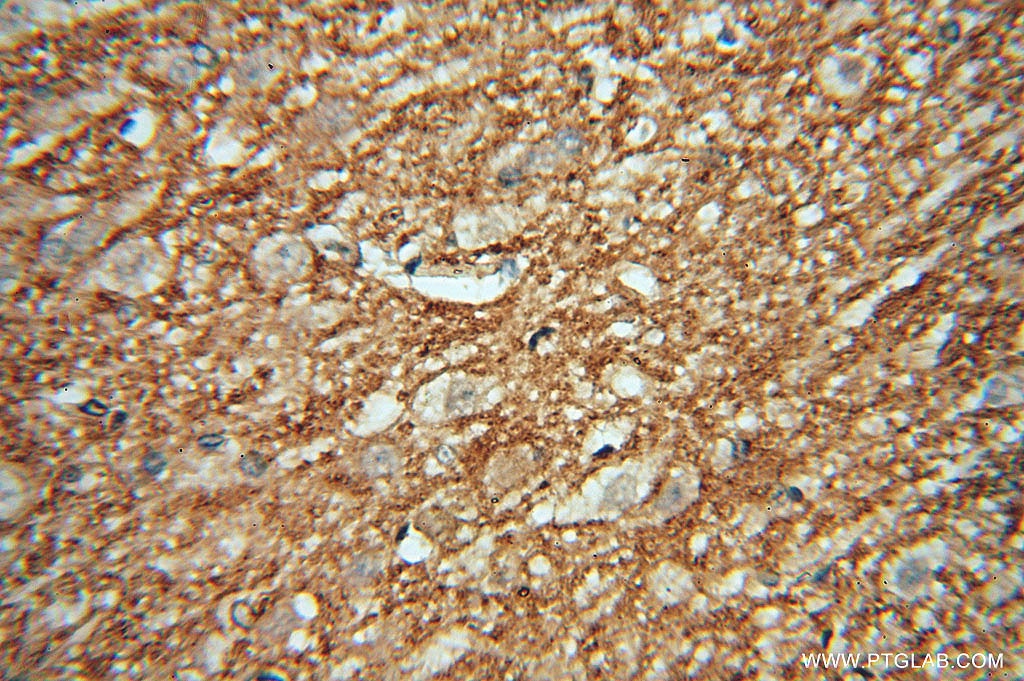 IHC staining of human brain using 15435-1-AP
