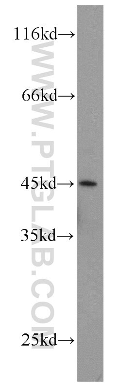 Western Blot (WB) analysis of human kidney tissue using CA11 Polyclonal antibody (15435-1-AP)