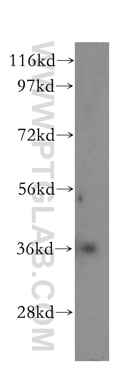 Western Blot (WB) analysis of human kidney tissue using CA11 Polyclonal antibody (15435-1-AP)