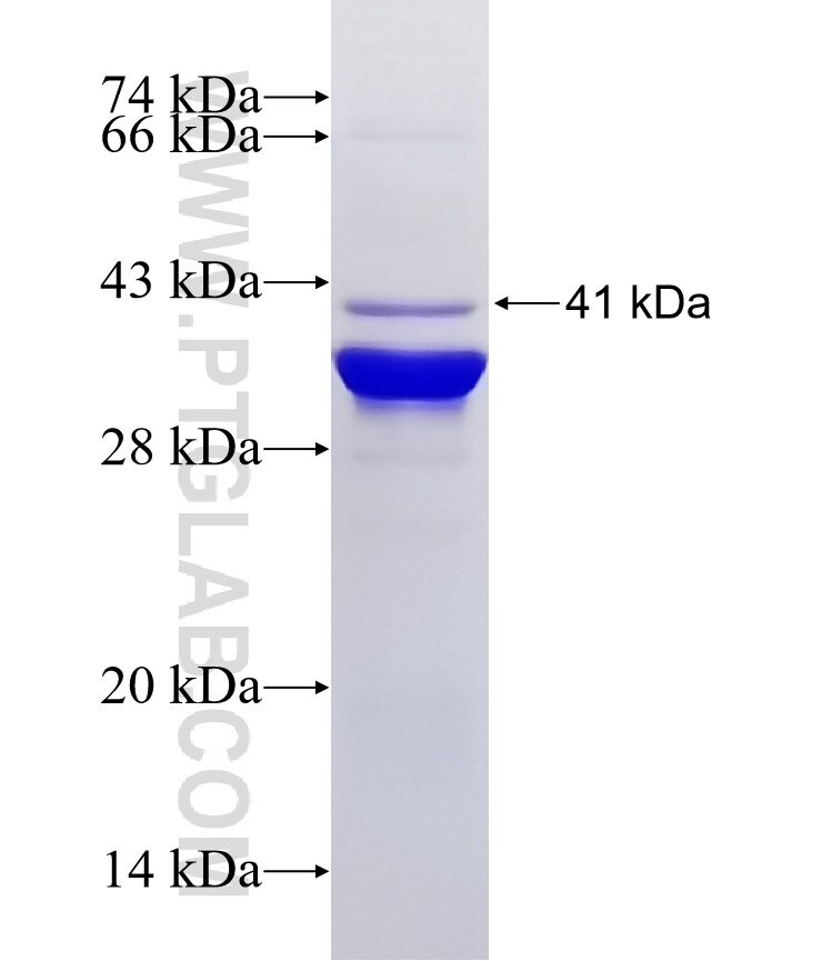 CA11 fusion protein Ag7863 SDS-PAGE
