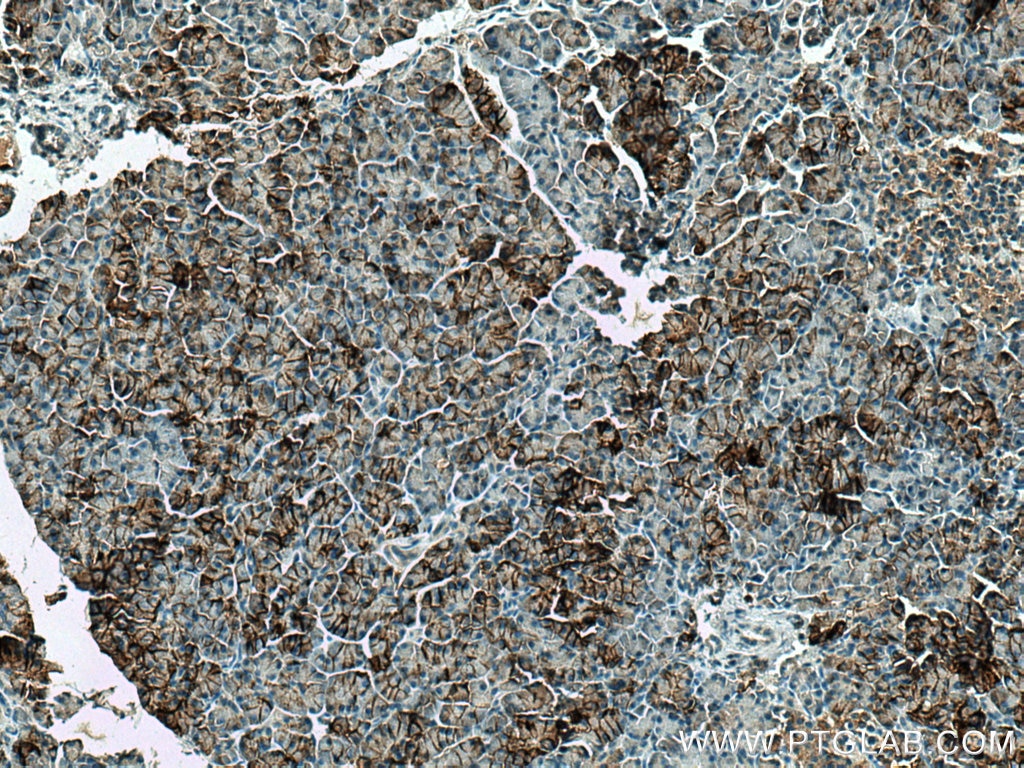 Immunohistochemistry (IHC) staining of human pancreas tissue using CA12 Polyclonal antibody (15180-1-AP)