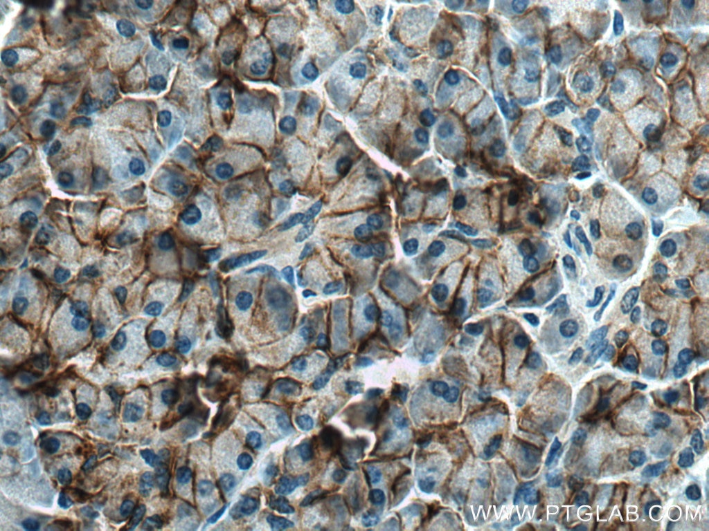 Immunohistochemistry (IHC) staining of human pancreas tissue using CA12 Polyclonal antibody (15180-1-AP)