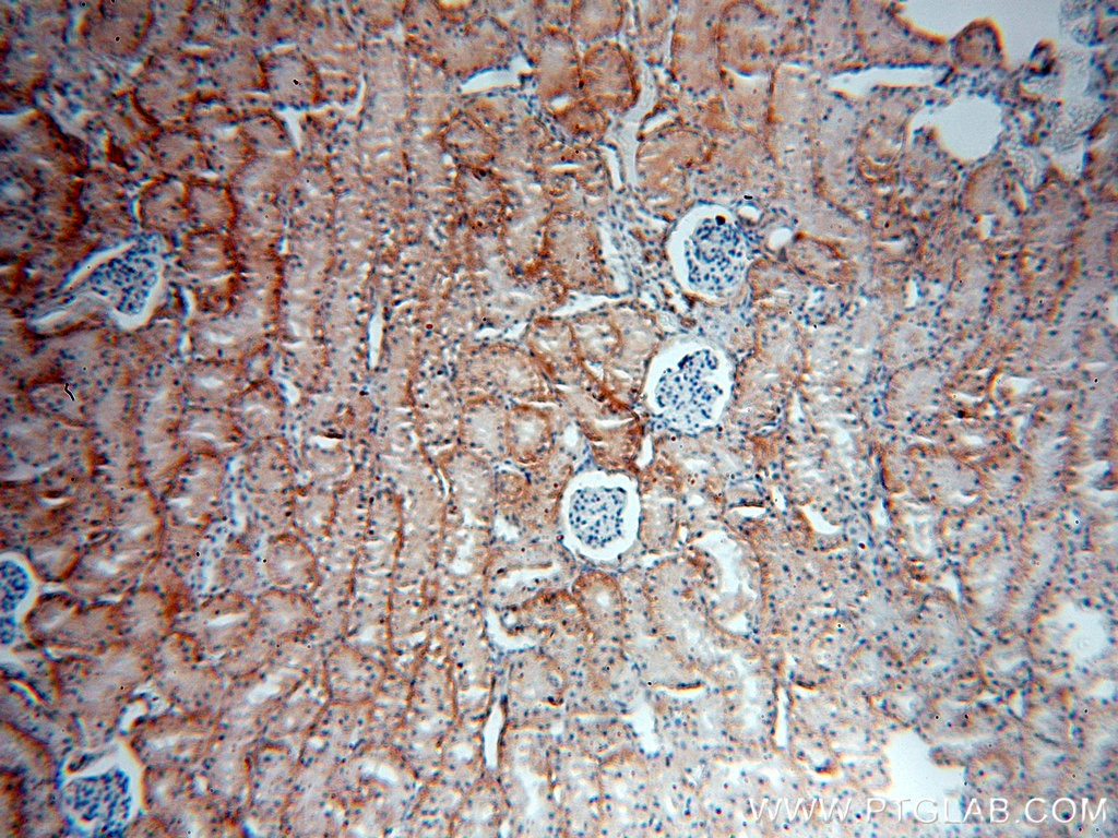 IHC staining of human kidney using 15180-1-AP