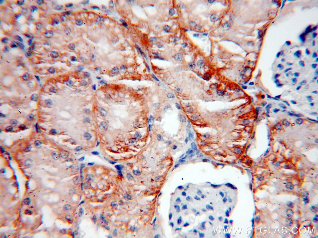 Immunohistochemistry (IHC) staining of human kidney tissue using CA12 Polyclonal antibody (15180-1-AP)