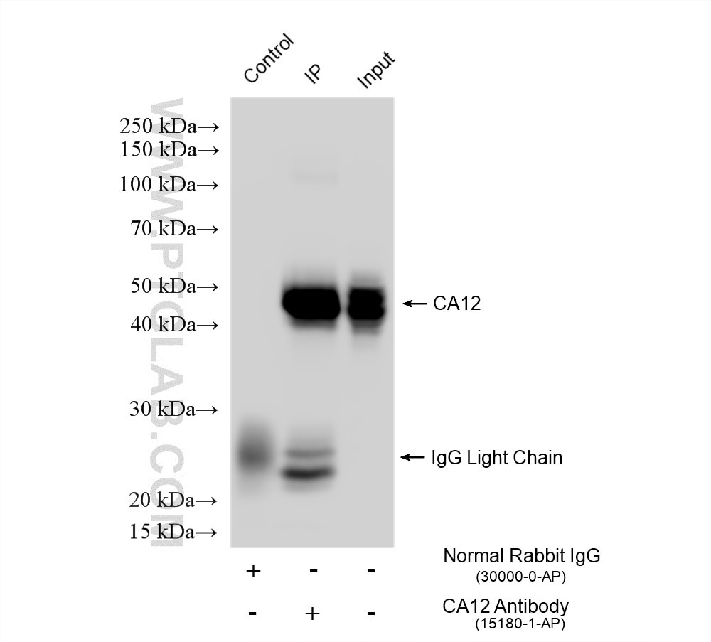 Immunoprecipitation (IP) experiment of A549 cells using CA12 Polyclonal antibody (15180-1-AP)