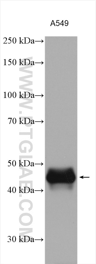 Western Blot (WB) analysis of various lysates using CA12 Polyclonal antibody (15180-1-AP)