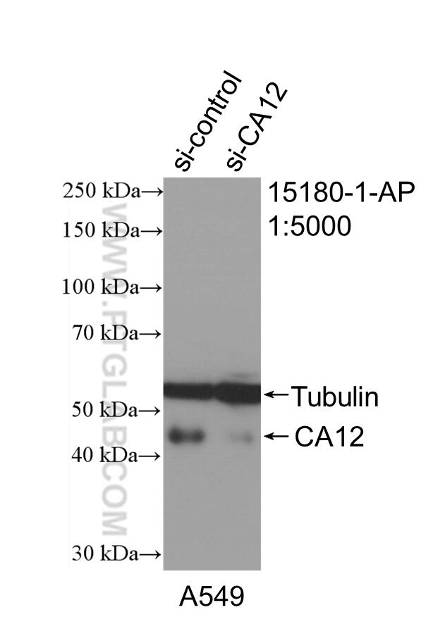 Western Blot (WB) analysis of A549 cells using CA12 Polyclonal antibody (15180-1-AP)