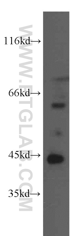 Western Blot (WB) analysis of BxPC-3 cells using CA12 Polyclonal antibody (15180-1-AP)