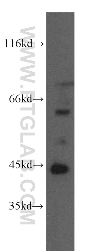 WB analysis of BxPC-3 using 15180-1-AP