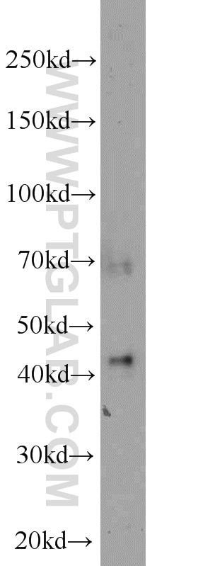 Western Blot (WB) analysis of PC-3 cells using CA12 Polyclonal antibody (15180-1-AP)