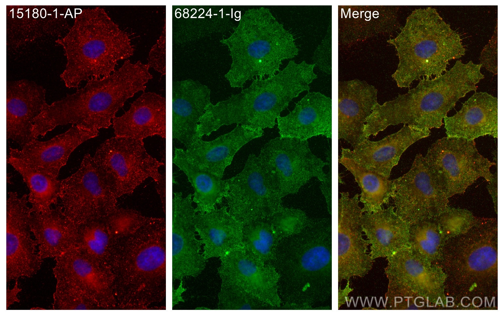 Immunofluorescence (IF) / fluorescent staining of A549 cells using CA12 Monoclonal antibody (68224-1-Ig)