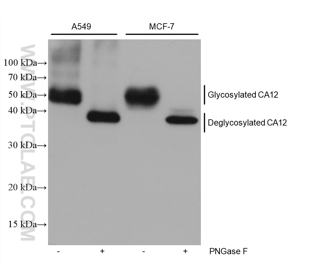 Western Blot (WB) analysis of various lysates using CA12 Monoclonal antibody (68224-1-Ig)