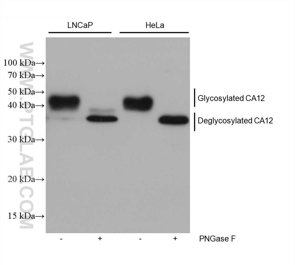 Western Blot (WB) analysis of various lysates using CA12 Monoclonal antibody (68224-1-Ig)