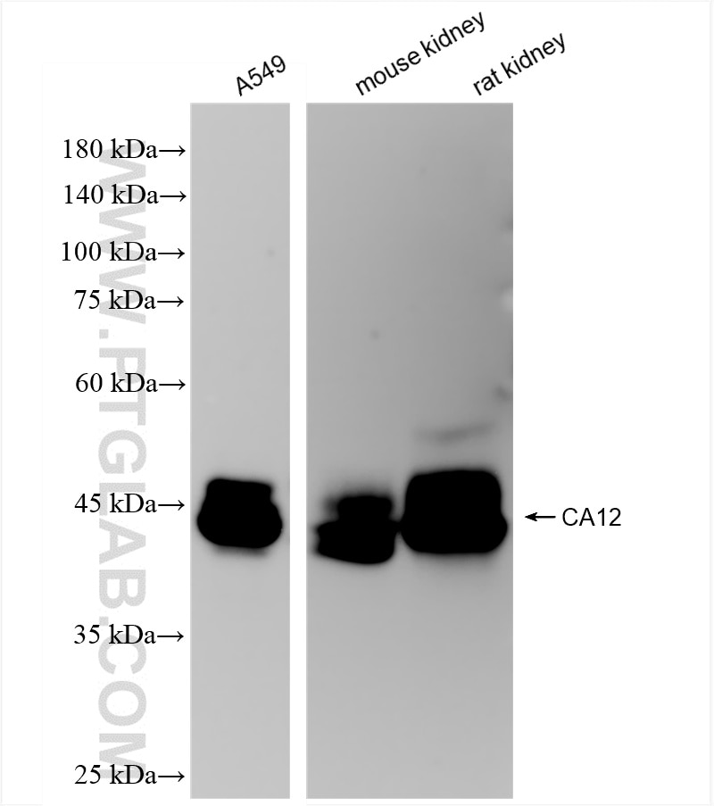 Western Blot (WB) analysis of various lysates using CA12 Recombinant antibody (85595-3-RR)
