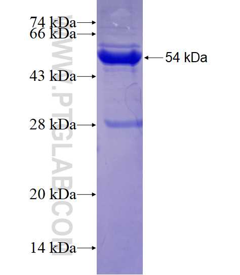 CA12 fusion protein Ag7107 SDS-PAGE