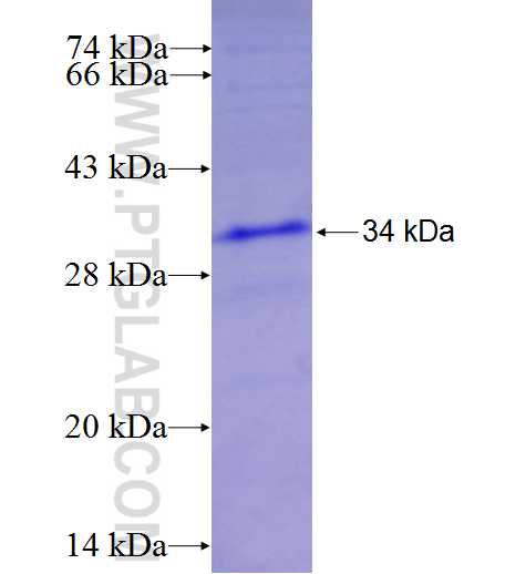 CA12 fusion protein Ag7235 SDS-PAGE