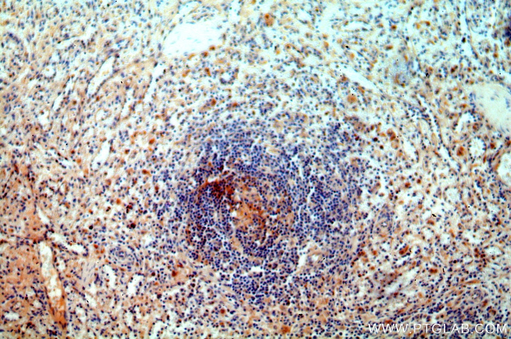 Immunohistochemistry (IHC) staining of human spleen tissue using CA13 Polyclonal antibody (16696-1-AP)