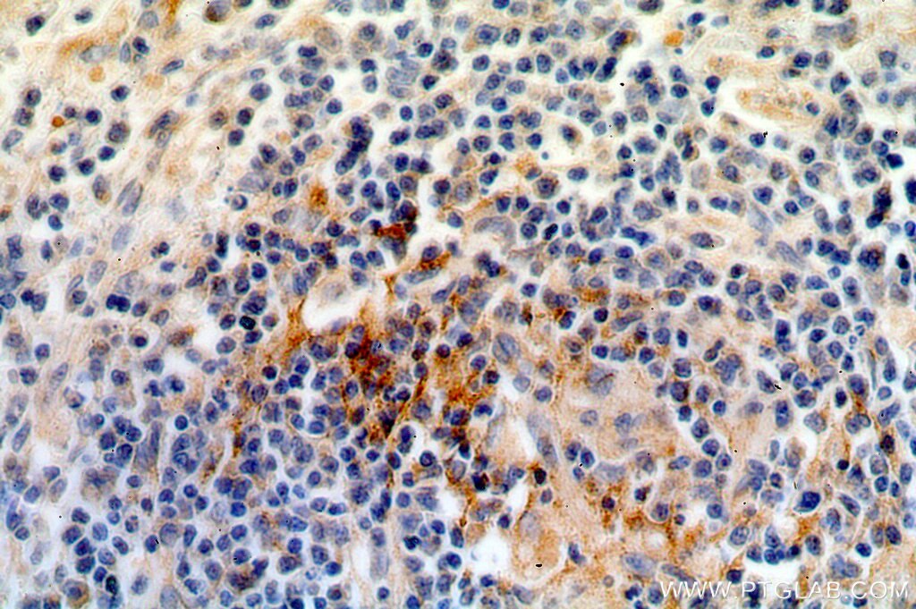 Immunohistochemistry (IHC) staining of human spleen tissue using CA13 Polyclonal antibody (16696-1-AP)