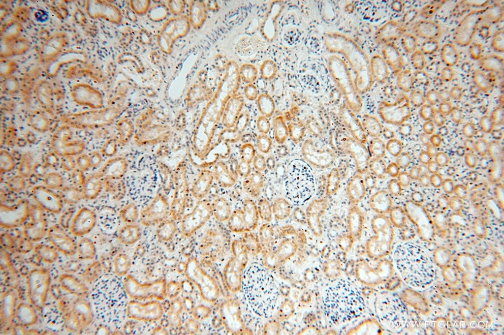 Immunohistochemistry (IHC) staining of human kidney tissue using CA13 Polyclonal antibody (16696-1-AP)