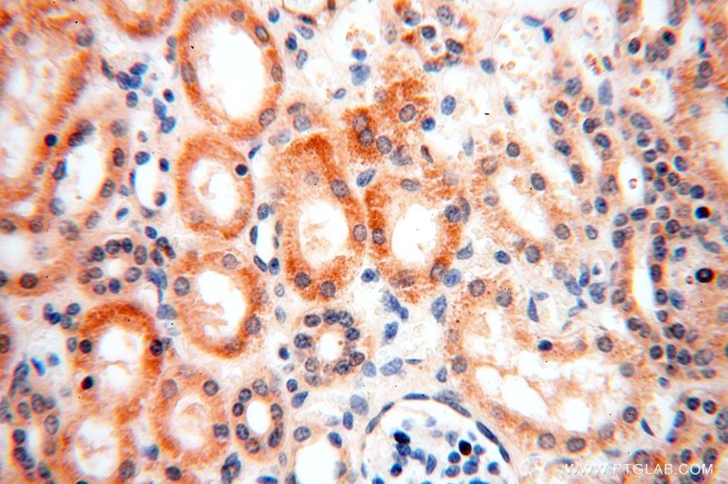 Immunohistochemistry (IHC) staining of human kidney tissue using CA13 Polyclonal antibody (16696-1-AP)