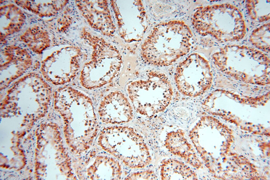 Immunohistochemistry (IHC) staining of human testis tissue using CA13 Polyclonal antibody (16696-1-AP)