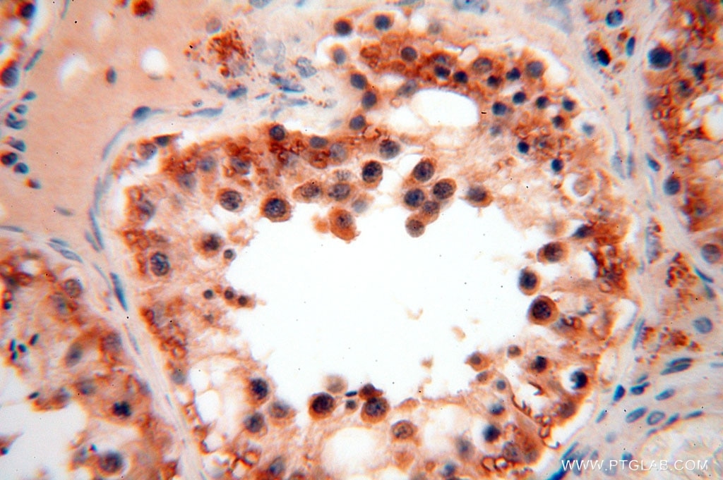 Immunohistochemistry (IHC) staining of human testis tissue using CA13 Polyclonal antibody (16696-1-AP)