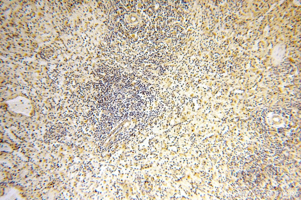 Immunohistochemistry (IHC) staining of human spleen tissue using CA13 Polyclonal antibody (16696-1-AP)