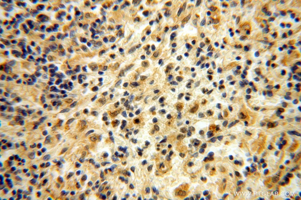 Immunohistochemistry (IHC) staining of human spleen tissue using CA13 Polyclonal antibody (16696-1-AP)