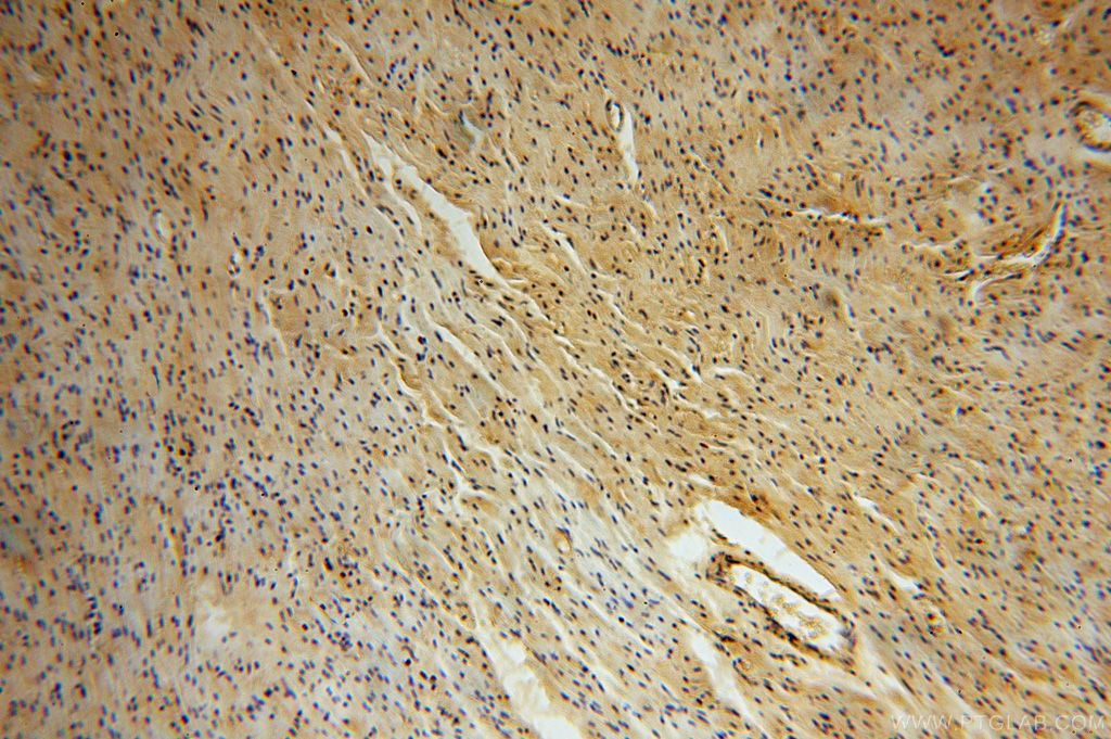 Immunohistochemistry (IHC) staining of human heart tissue using CA13 Polyclonal antibody (16696-1-AP)