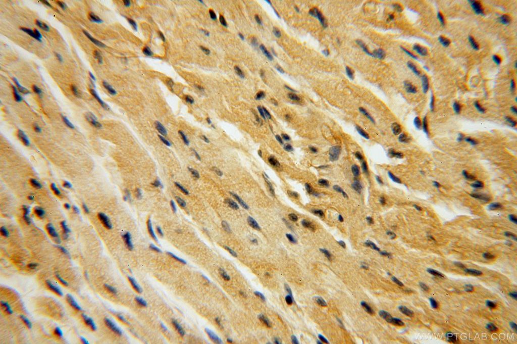 Immunohistochemistry (IHC) staining of human heart tissue using CA13 Polyclonal antibody (16696-1-AP)