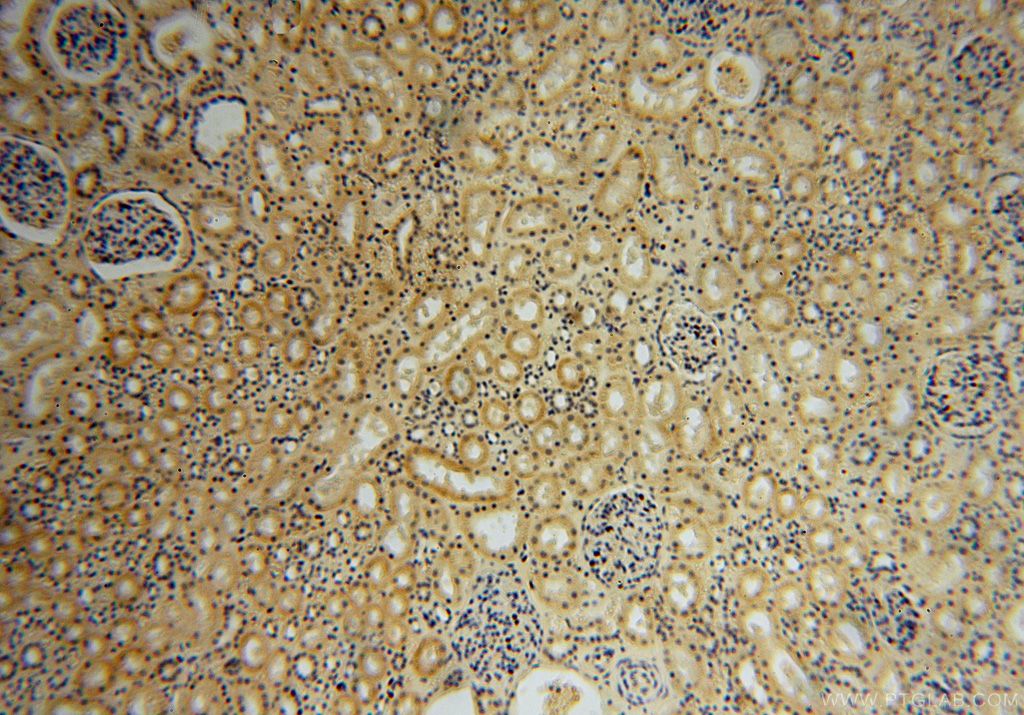 Immunohistochemistry (IHC) staining of human kidney tissue using CA13 Polyclonal antibody (16696-1-AP)