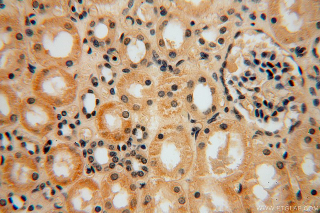 IHC staining of human kidney using 16696-1-AP