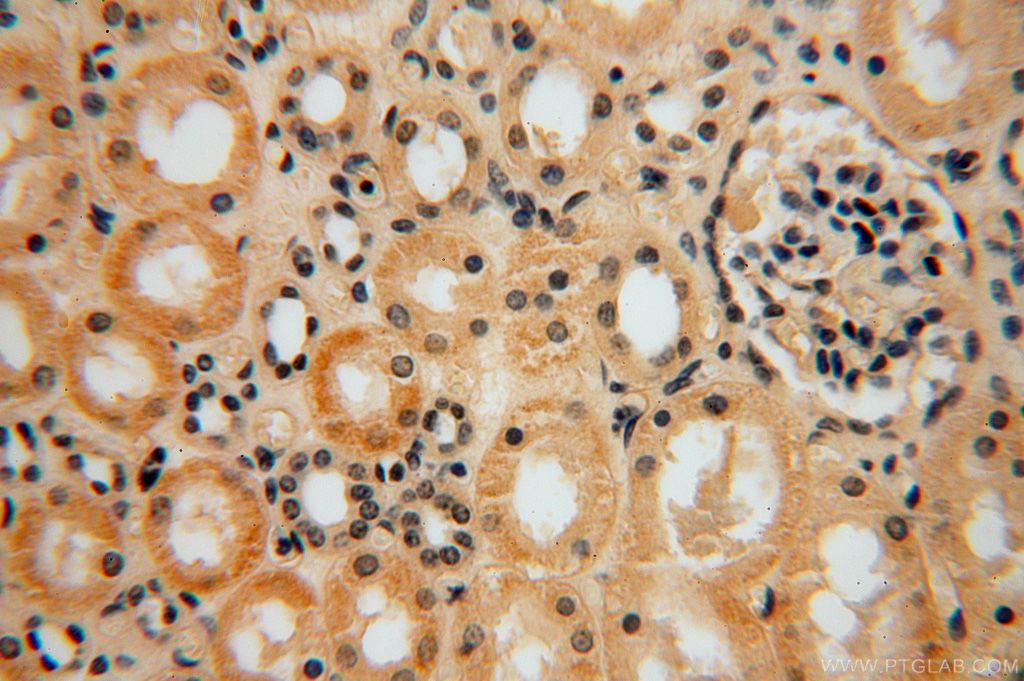 Immunohistochemistry (IHC) staining of human kidney tissue using CA13 Polyclonal antibody (16696-1-AP)