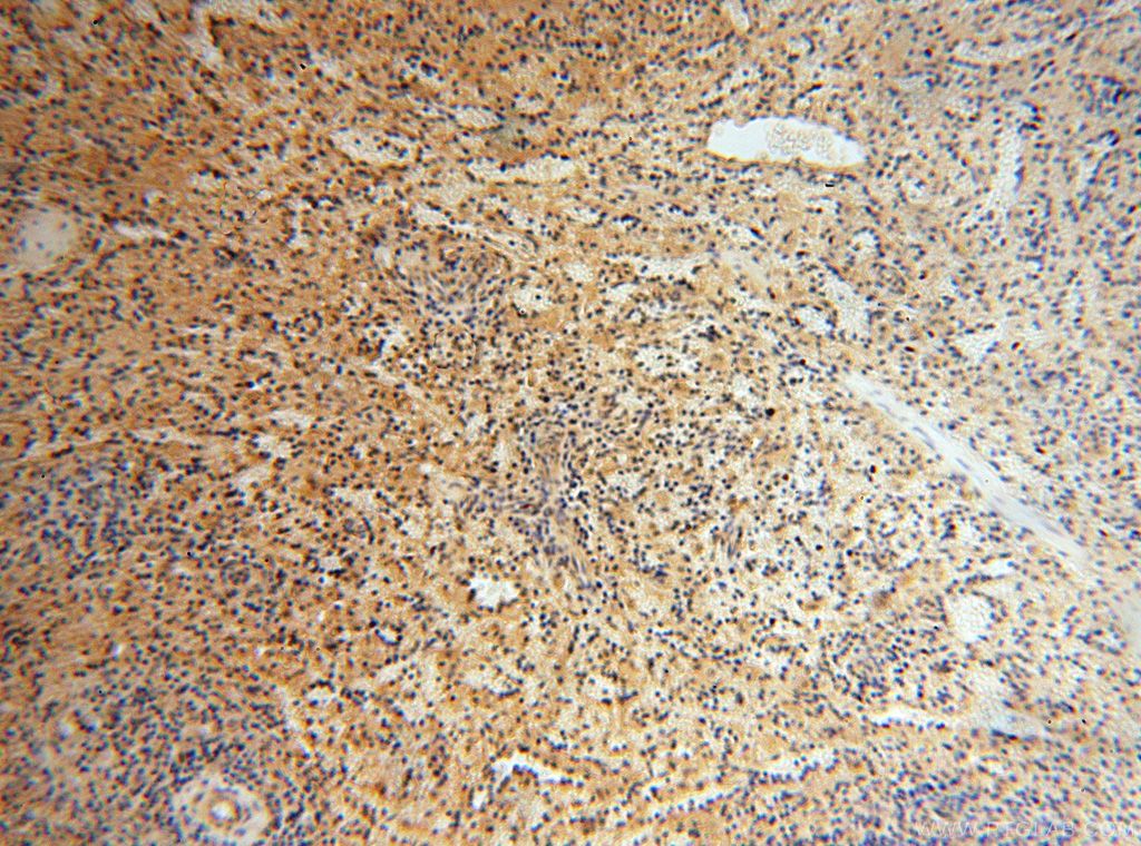 Immunohistochemistry (IHC) staining of human spleen tissue using CA13 Polyclonal antibody (16696-1-AP)