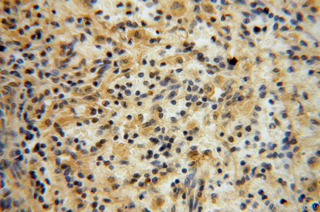 Immunohistochemistry (IHC) staining of human spleen tissue using CA13 Polyclonal antibody (16696-1-AP)