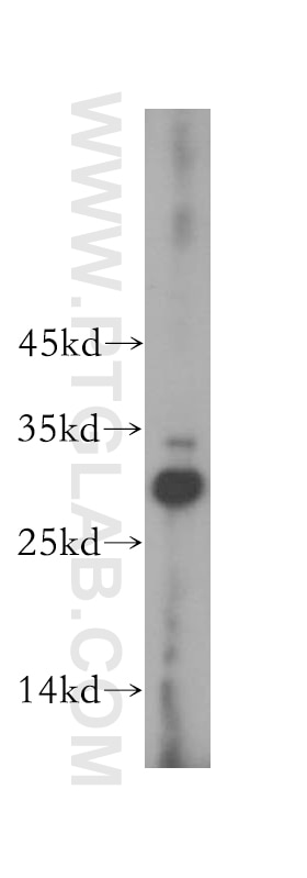 Western Blot (WB) analysis of mouse skeletal muscle tissue using CA13 Polyclonal antibody (16696-1-AP)