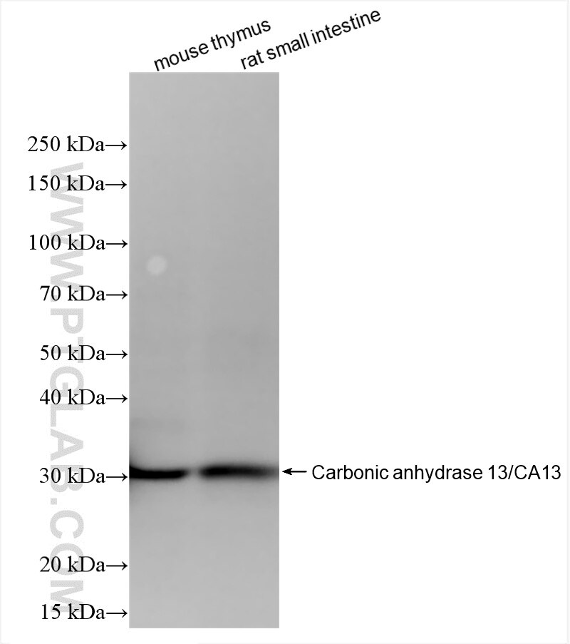 Western Blot (WB) analysis of various lysates using CA13 Recombinant antibody (86178-1-RR)
