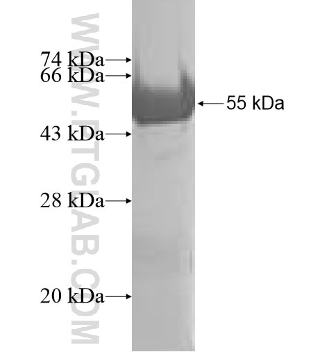 CA13 fusion protein Ag10086 SDS-PAGE