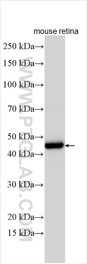 Western Blot (WB) analysis of various lysates using CA14 Polyclonal antibody (13736-1-AP)