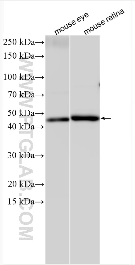 Western Blot (WB) analysis of various lysates using CA14 Polyclonal antibody (13736-1-AP)
