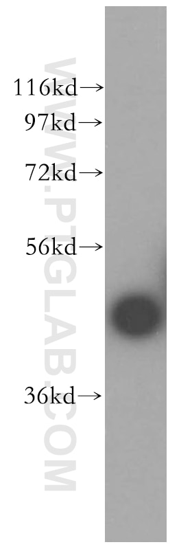 Western Blot (WB) analysis of mouse eye tissue using CA14 Polyclonal antibody (13736-1-AP)